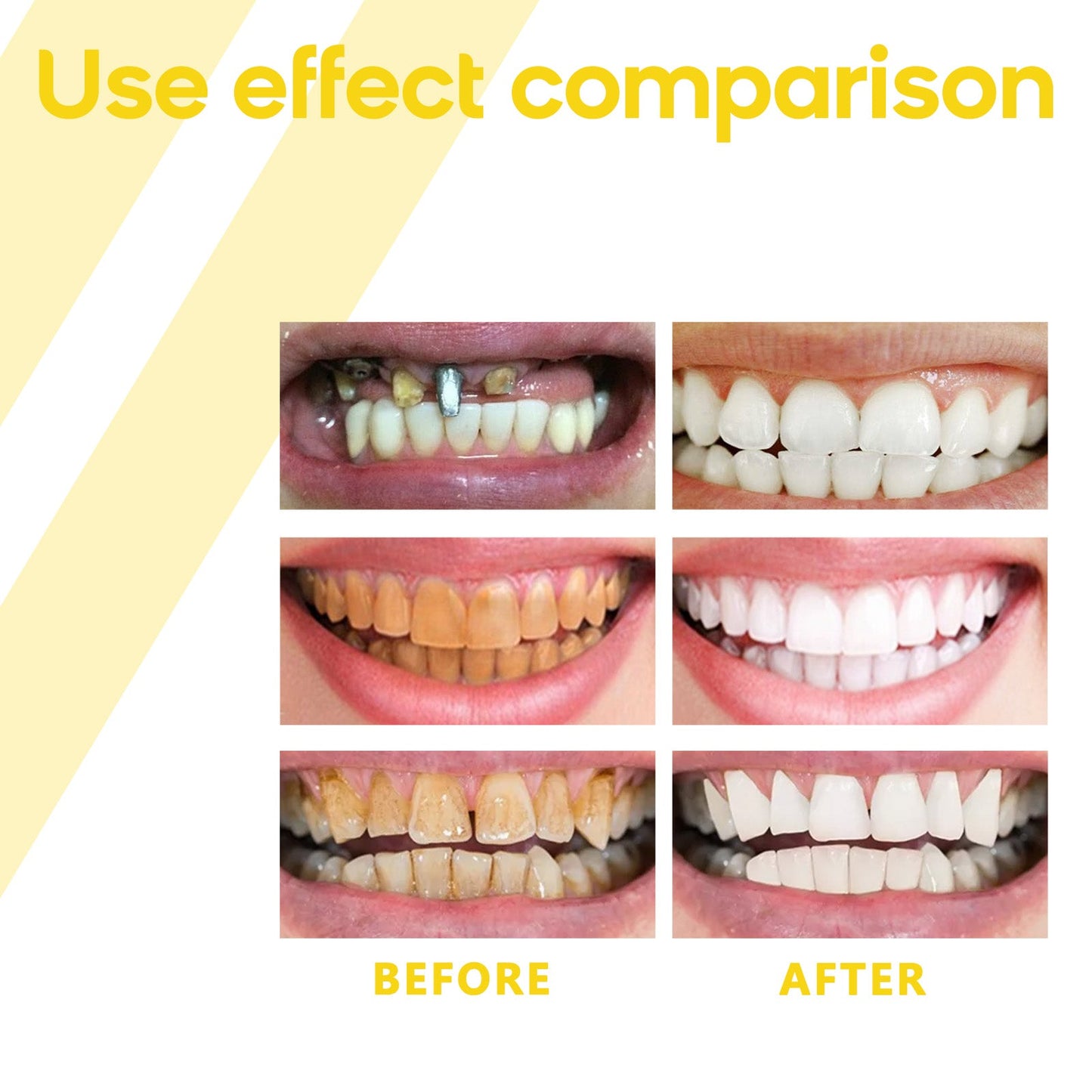 Oralhoe Propolis Gum Care Gel Oral care, cleaning, repairing yellow teeth and dental stains, whitening teeth