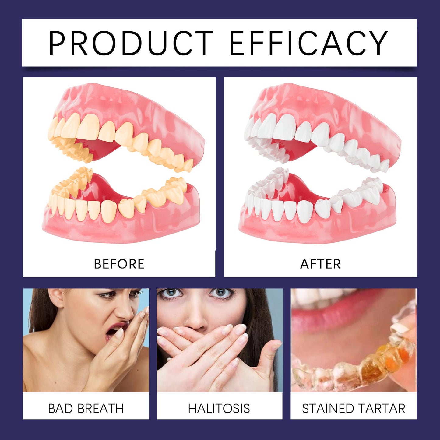 Oralhoe Mouthguard cleaning tablets Care for dentures and braces, oral cleaning, stain removal, cleaning tablets, care