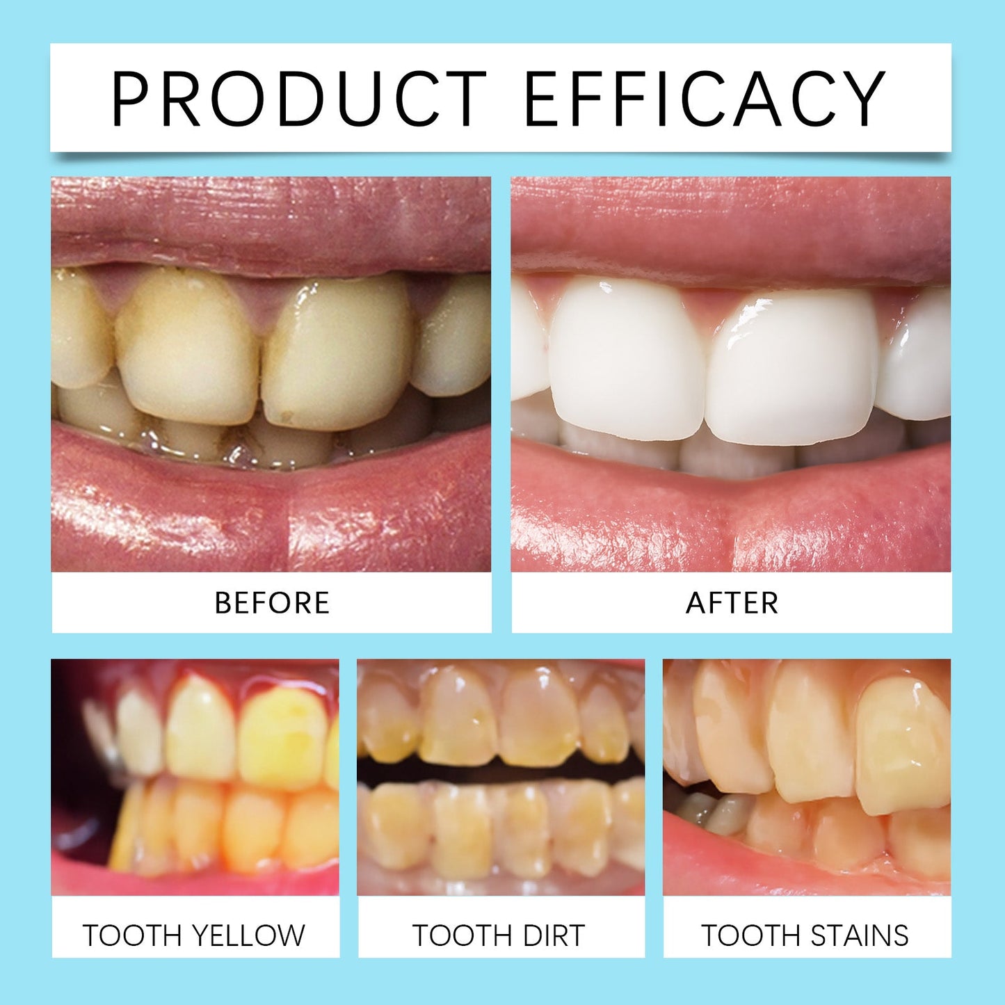 Oralhoe Denture cleaning effervescent tablets Cleans corner impurities, maintains comfort of wear, and provides dental hygiene care