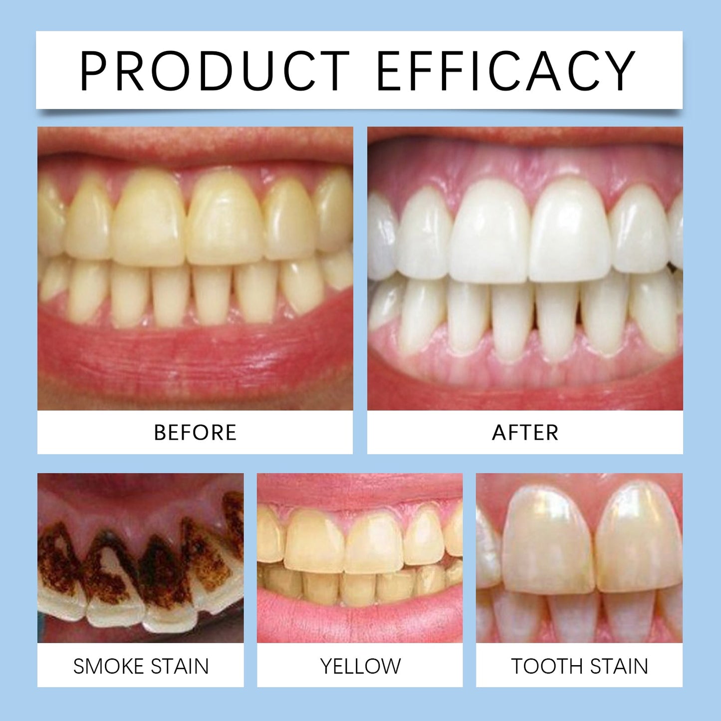 Oralhoe Mint Fresh Toothpaste Tablets Cleans dental stains, yellow teeth, and bad breath, and brightens the tooth surface with care tablets