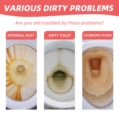 Jakehoe Toilet Effervescent Tablets Toilet cleaner for removing odors, yellow stains, dirt, and urine marks; toilet bowl cleaning tablets