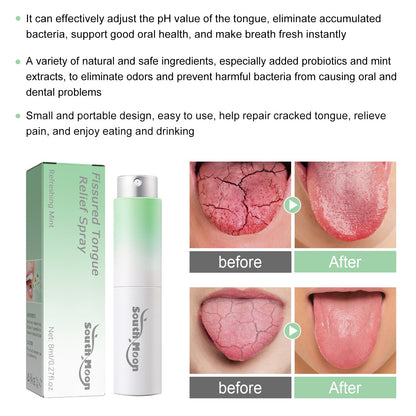 South Moon Cracked Tongue Relief Spray Relieves tongue cracks, freshens breath, and eliminates bad odor oral spray