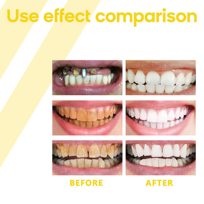Oralhoe Propolis Gum Care Gel Oral care, cleaning, repairing yellow teeth and dental stains, whitening teeth