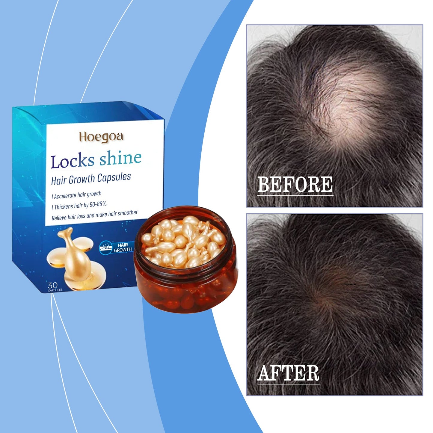 HOEGOA Hair Care Capsules Scalp Repair Essential Oil, Hair Smoothing Care Essence, No-Rinse Hair Care Capsules