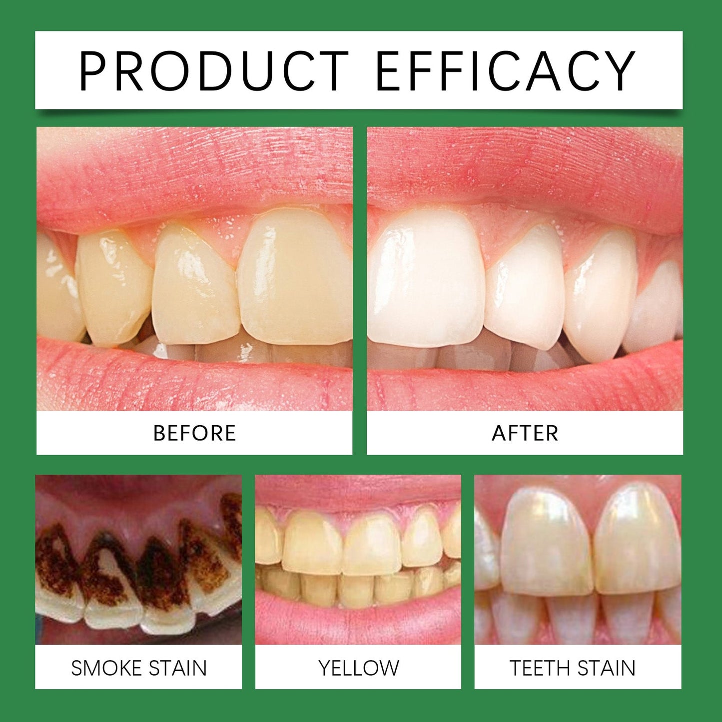 Oralhoe Denture cleaning tablets Cleaning and care, freshening, removing tooth stains, gentle care for braces and dentures, cleaning tablets