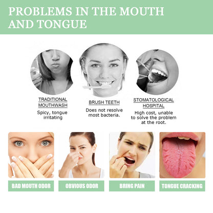 South Moon Cracked Tongue Relief Spray Relieves tongue cracks, freshens breath, and eliminates bad odor oral spray