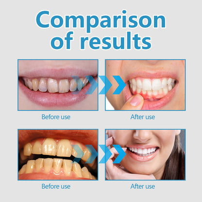 EELHOE Gum Oral Gel Pen Cleans dental stains, protects gums, whitens teeth, oral care gel pen