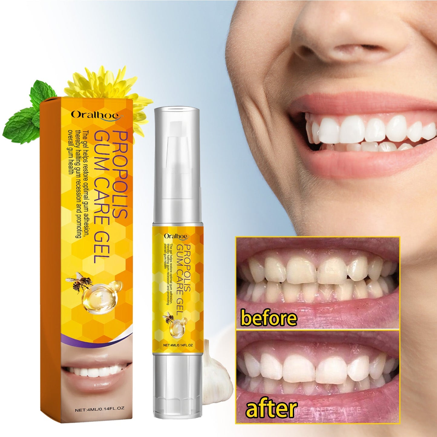 Oralhoe Propolis Gum Care Gel Oral care, cleaning, repairing yellow teeth and dental stains, whitening teeth