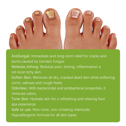 West&Month Ginger foot bath tablets Foot care foot soak tablets for repairing onychomycosis, brightening nails, and eliminating odor