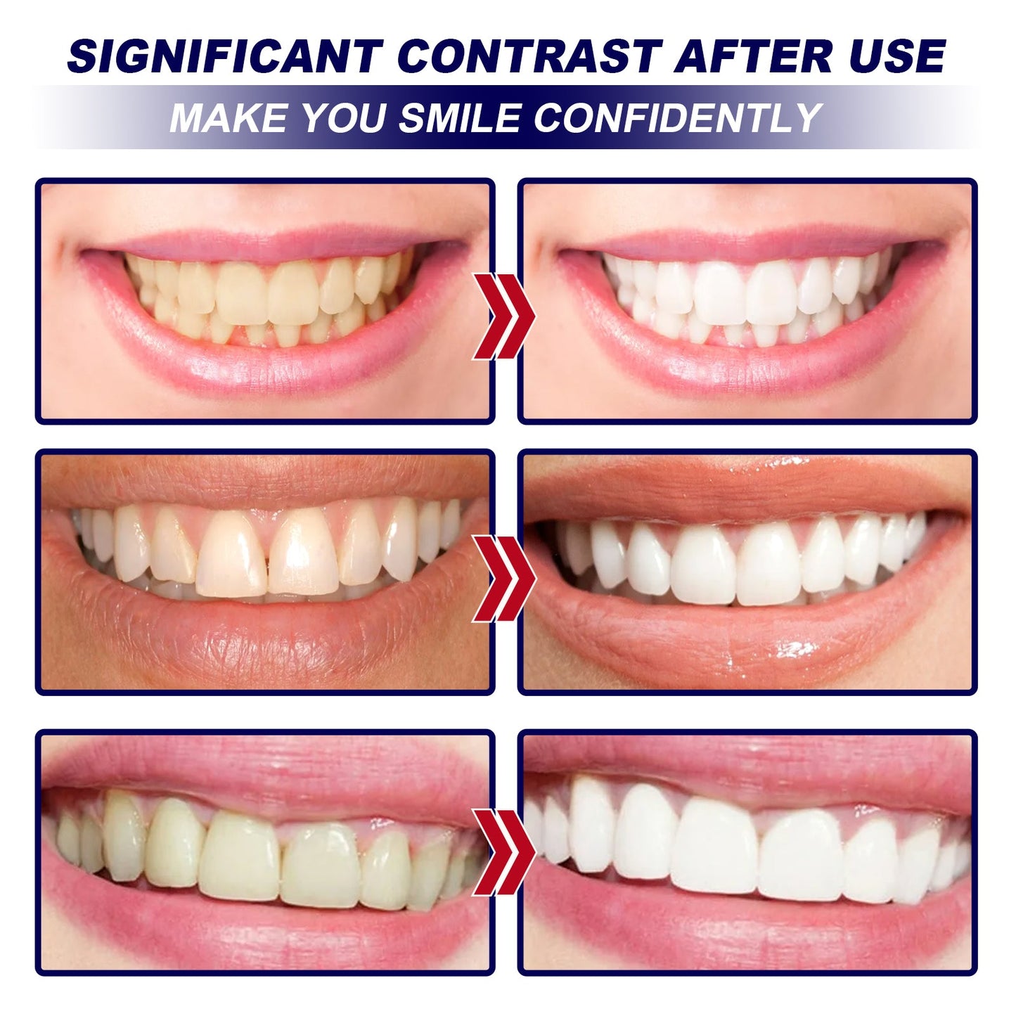 EELHOE Whitening tooth strips Dental care stain remover, whitening and cleaning strips