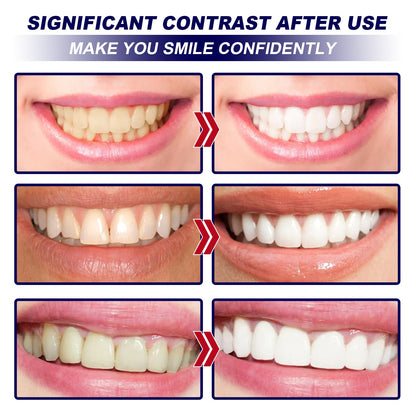 EELHOE Whitening tooth strips Dental care stain remover, whitening and cleaning strips