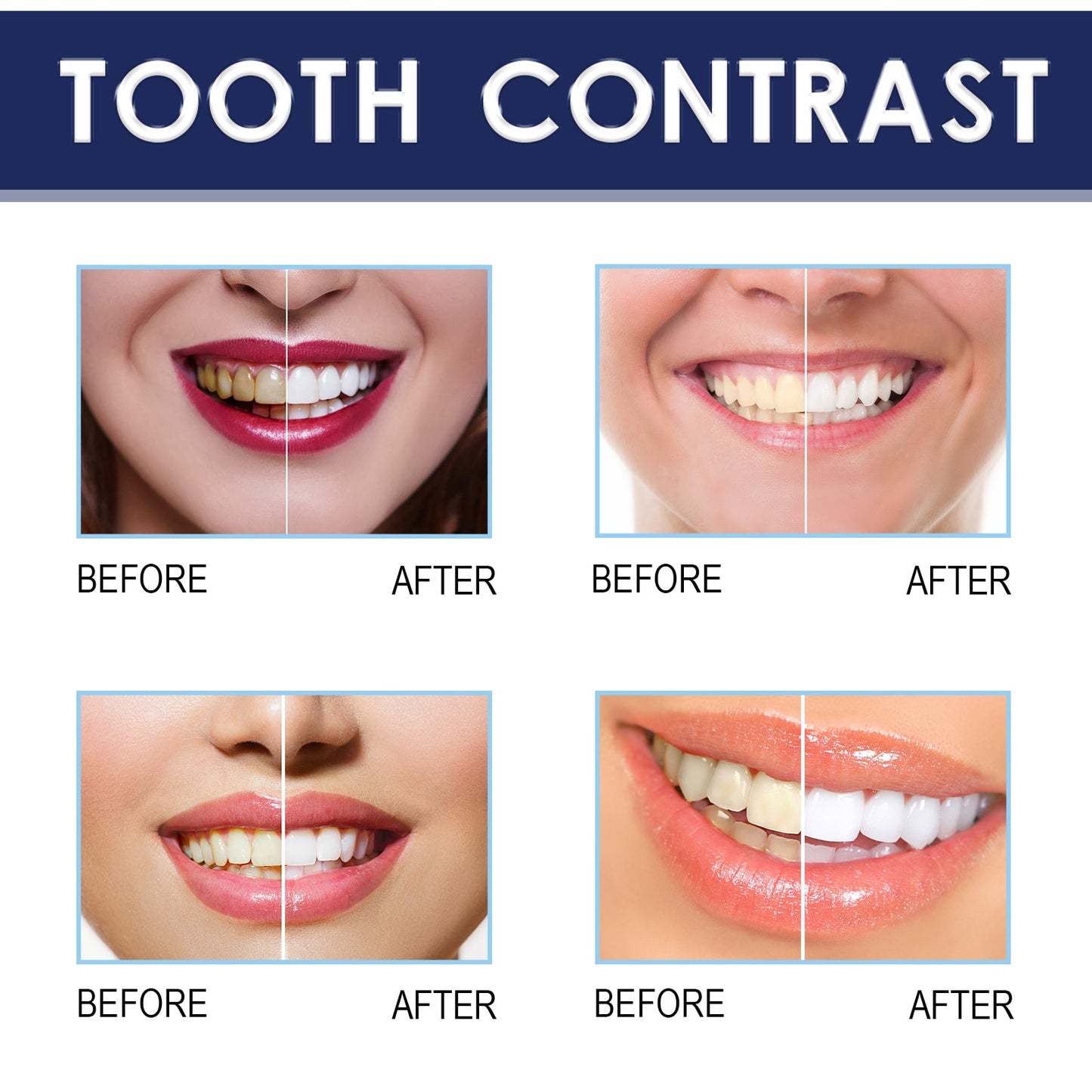 OUHOE Teeth Whitening Essence Pen Teeth Whitening and Brightening Pen