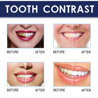 OUHOE Teeth Whitening Essence Pen Teeth Whitening and Brightening Pen