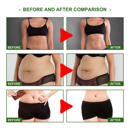 OUHOE Herbal Slimming Navel Patch Body Shaping Thigh Firming Slimming Belt with Magnetic Navel Patch