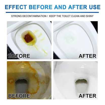 Jue-Fish Toilet cleaning tablets Toilet deodorizing and descaling tablets for removing urine stains and cleaning toilet drains