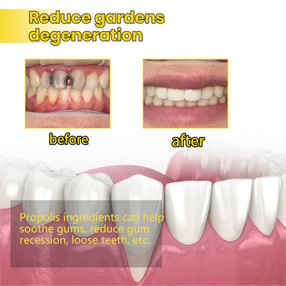 Oralhoe Propolis Gum Care Gel Oral care, cleaning, repairing yellow teeth and dental stains, whitening teeth