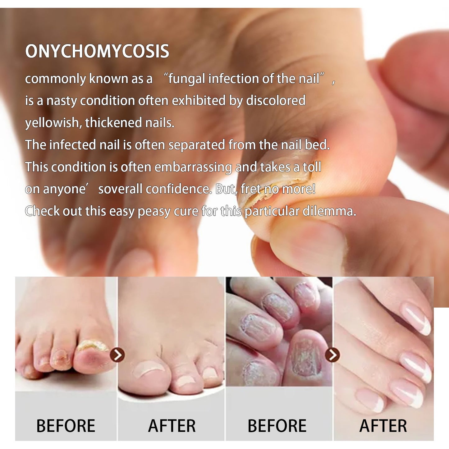 West&Month Ginger foot bath tablets Foot care foot soak tablets for repairing onychomycosis, brightening nails, and eliminating odor