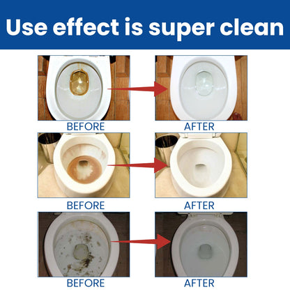 Jaysuing Toilet cleaning effervescent tablets Household descaling, deodorizing, and stain-removing toilet cleaner