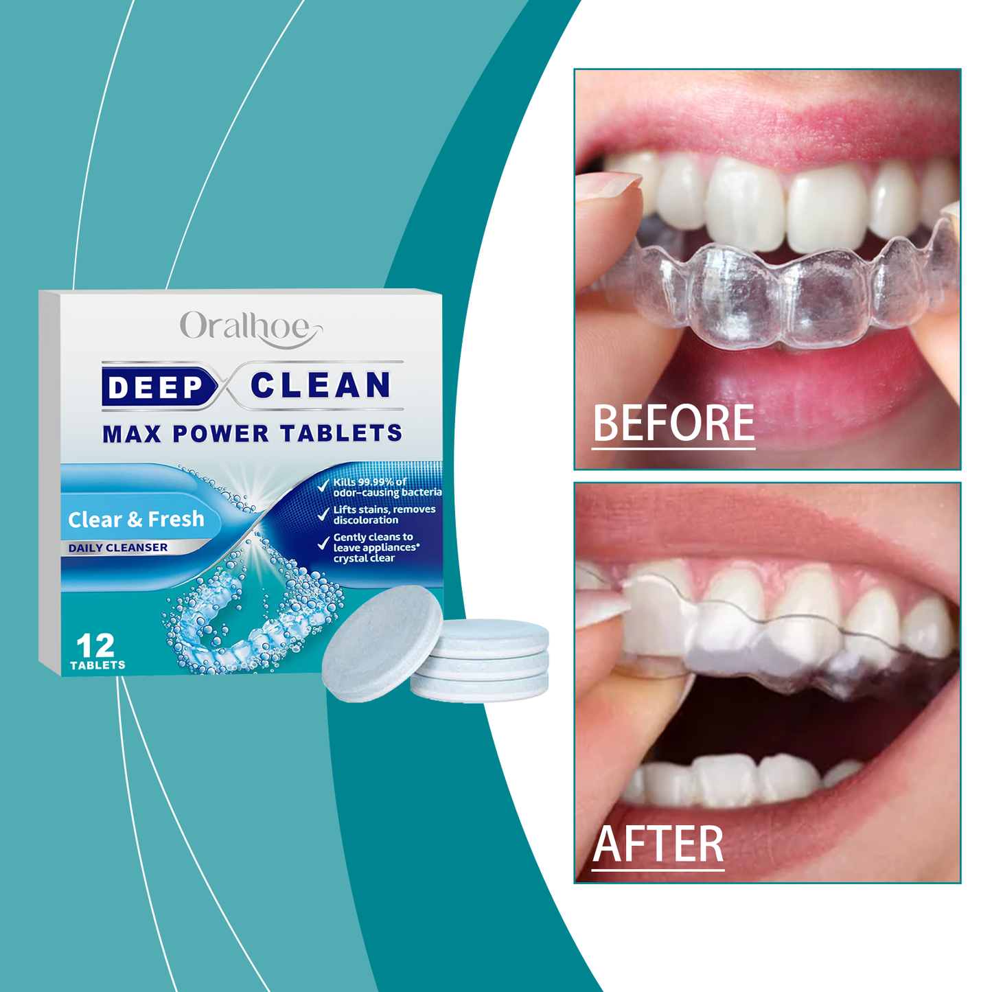 Oralhoe Dental aligner cleaning effervescent tablets Dental aligner odor-removing gentle stain-removing cleaning tablets