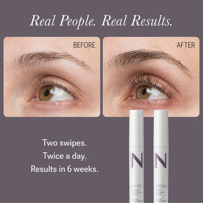Solution Serum System