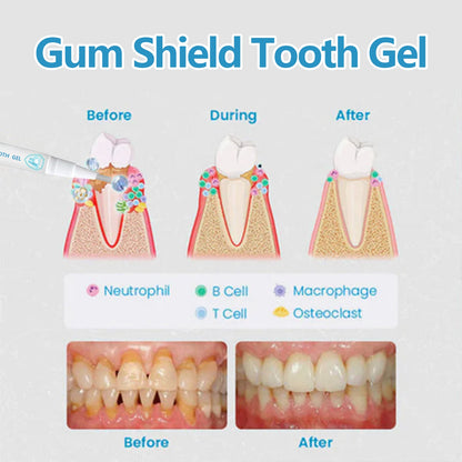EELHOE Gum Oral Gel Pen Cleans dental stains, protects gums, whitens teeth, oral care gel pen
