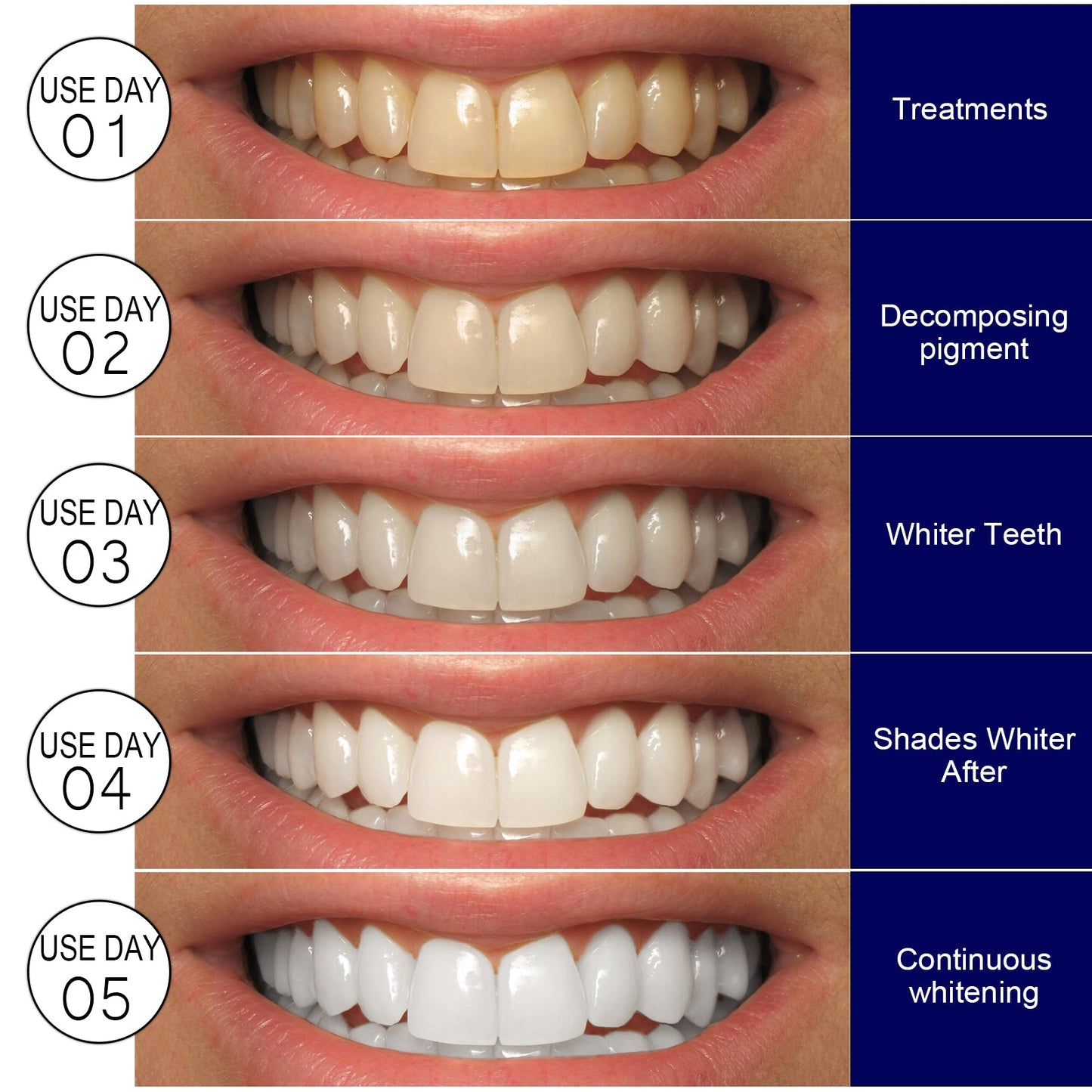 EELHOE Whitening tooth strips Dental care stain remover, whitening and cleaning strips