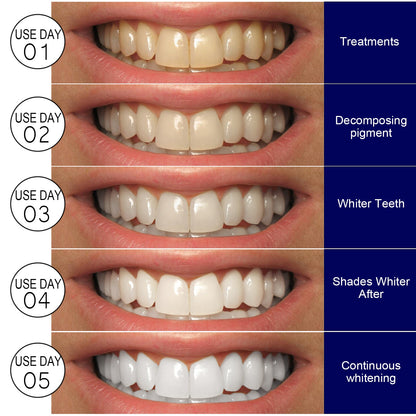 EELHOE Whitening tooth strips Dental care stain remover, whitening and cleaning strips