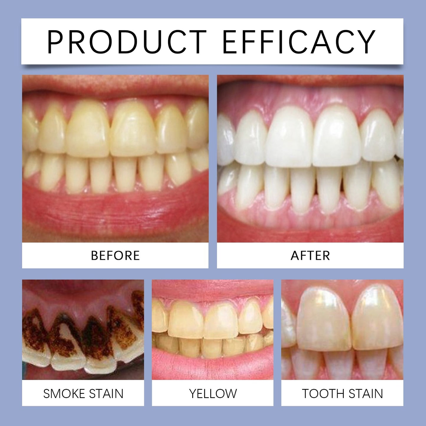 EELHOE Fresh Breath Mouthwash Tablets Clean oral hygiene, care for shiny teeth, portable solid toothpaste tablets