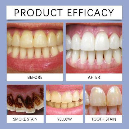 EELHOE Fresh Breath Mouthwash Tablets Clean oral hygiene, care for shiny teeth, portable solid toothpaste tablets