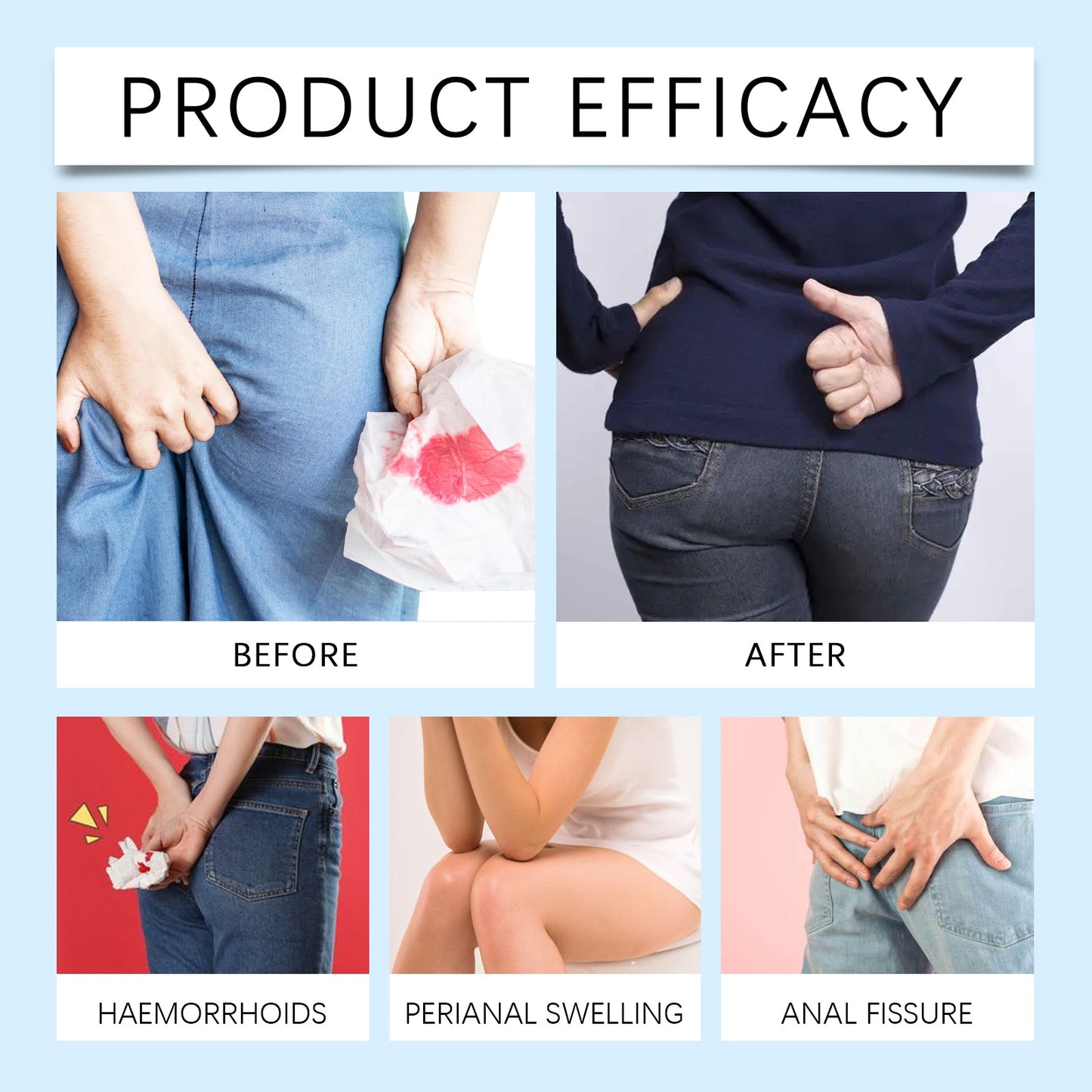 Ximonth Herbal Hemorrhoid Capsules Relieves Anal Discomfort, Eliminates Hemorrhoids, Body Care, Anal Comfort Care Capsules