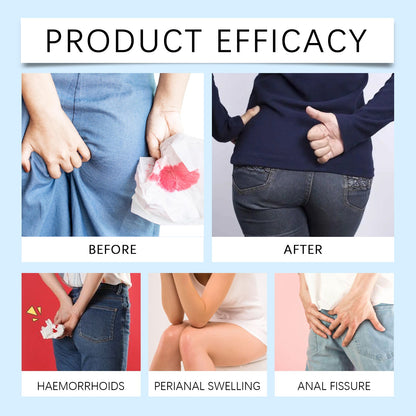 Ximonth Herbal Hemorrhoid Capsules Relieves Anal Discomfort, Eliminates Hemorrhoids, Body Care, Anal Comfort Care Capsules