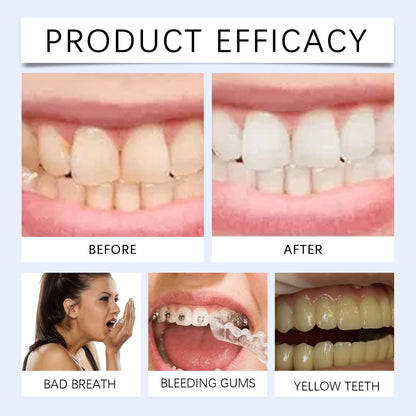 Oralhoe Dental retainer cleaning effervescent tablets Fresh Breath Dental Braces Denture Cleaning Stain Care Effervescent Tablets