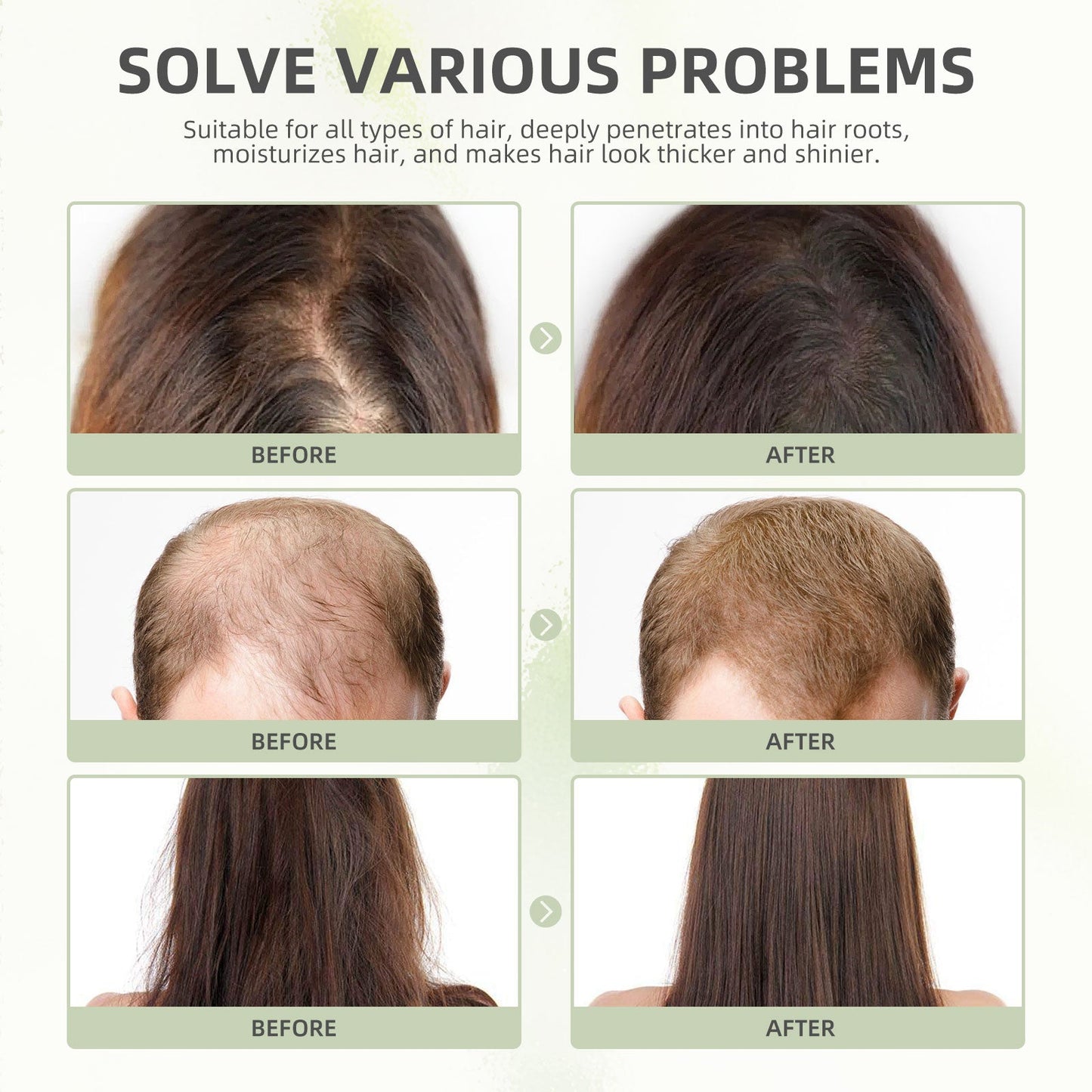 eelhoe Castor Oil Hair Thickening Capsules Repair hair damage, nourish, smooth, shine and strengthen hair, hair care capsules