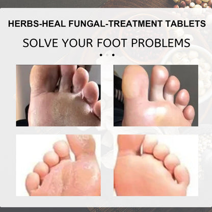 EELHOE Foot soak tablets Peeled ginger foot soak tablets for foot care, to dispel cold and dampness, and repair onychomycosis