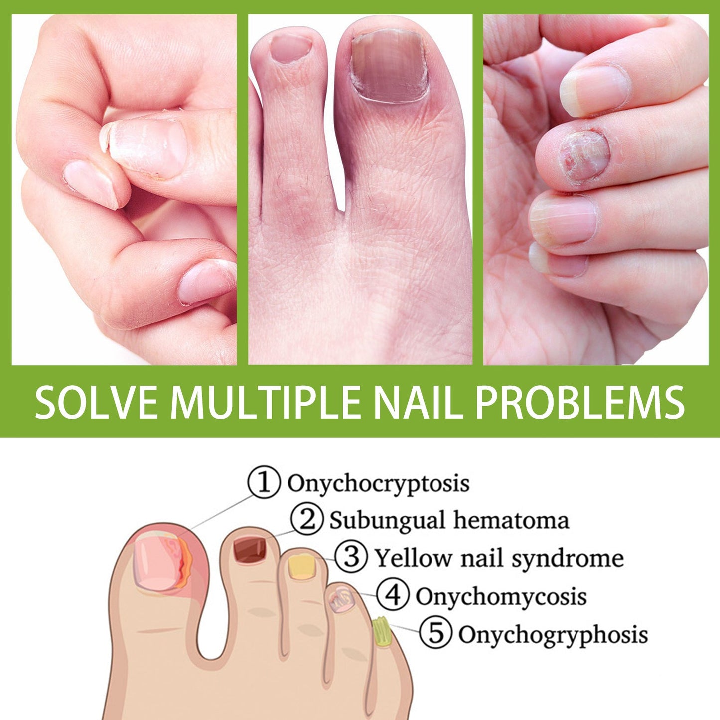 West&Month Ginger foot bath tablets Foot care foot soak tablets for repairing onychomycosis, brightening nails, and eliminating odor