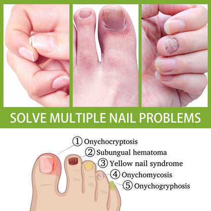 West&Month Ginger foot bath tablets Foot care foot soak tablets for repairing onychomycosis, brightening nails, and eliminating odor