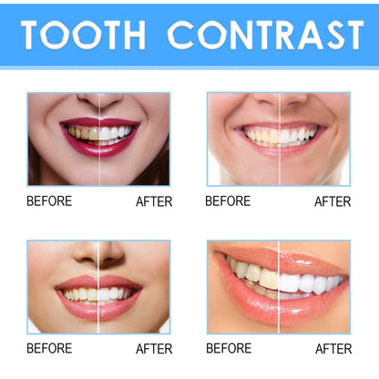West&Month Teeth Whitening Repair Pen Oral Care Teeth Whitening Brightening Pen
