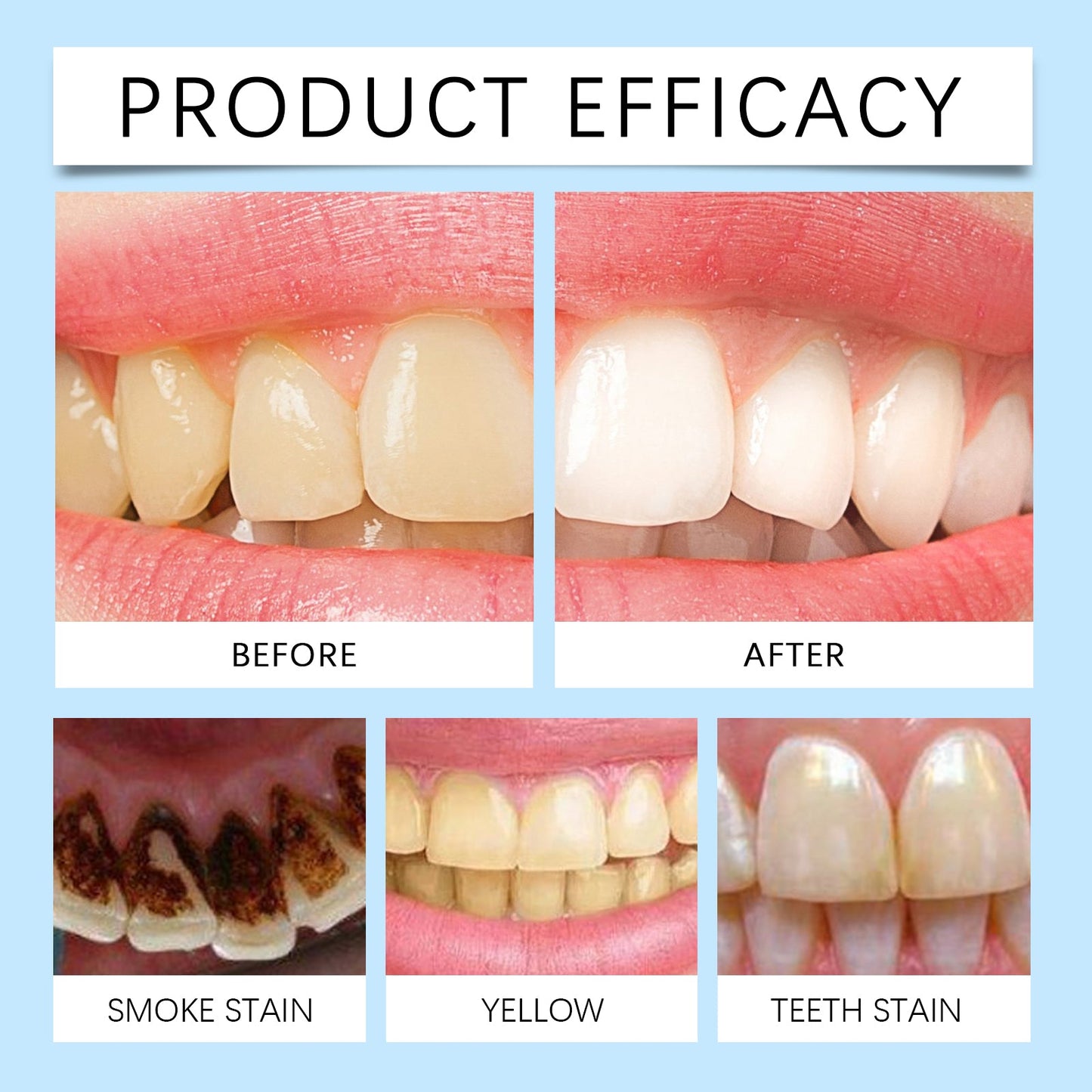Oralhoe Denture cleaning effervescent tablets Gentle cleaning of denture stains, fresh and clean, daily portable effervescent tablets