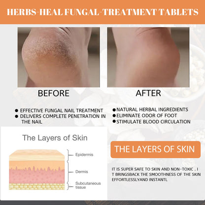 EELHOE Foot soak tablets Peeled ginger foot soak tablets for foot care, to dispel cold and dampness, and repair onychomycosis