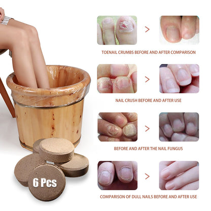 West&Month Ginger foot bath tablets Foot care foot soak tablets for repairing onychomycosis, brightening nails, and eliminating odor