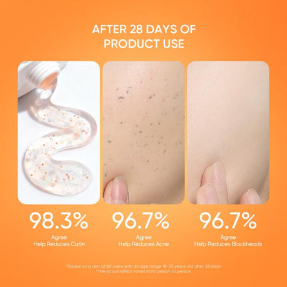 🔥Orange Enzyme Exfoliating Gel — The Gentle Miracle Your Skin Has Been Crying Out For