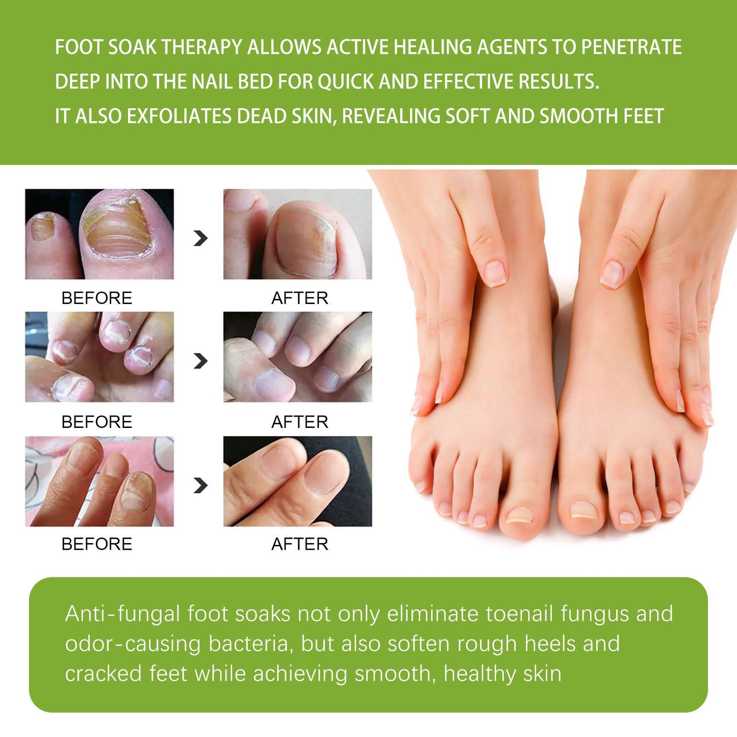 West&Month Ginger foot bath tablets Foot care foot soak tablets for repairing onychomycosis, brightening nails, and eliminating odor
