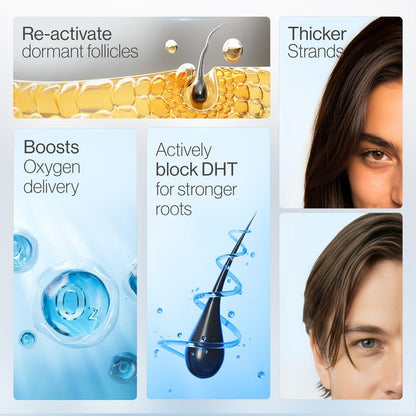 Advanced Hair Growth Roll on