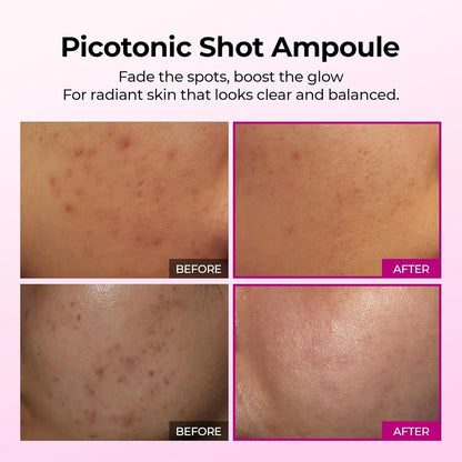 Dr.Melaxin Cemenrete Picotonic Shot Calcium Serum for Firming Density collagen s-Shop