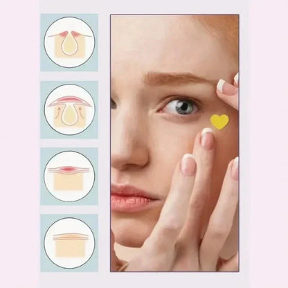 Pimple Patches for Face, 200 Pcs in 5 Sizes & Colors, Hydrocolloid Acne Treatmen-Shop